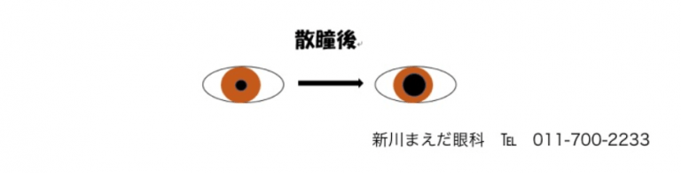 散瞳について | 医療法人祥仁会 新川まえだ眼科